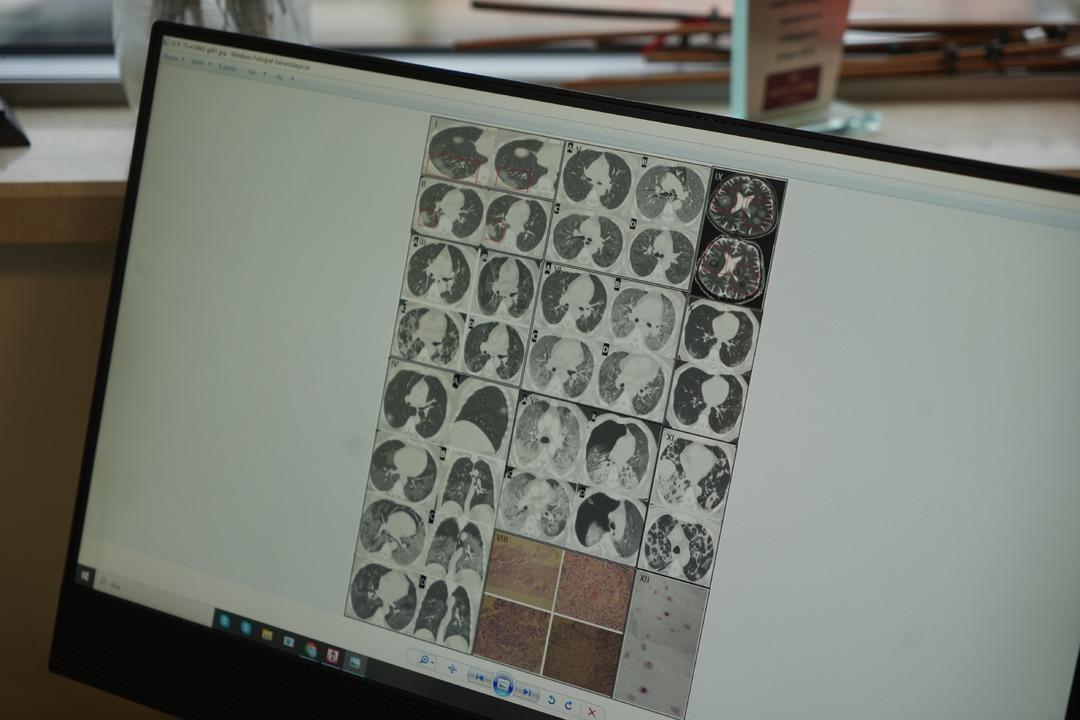 Gençlerde ani ölümler artıyor! Uzmanın adı 2. nedeni açıkladı